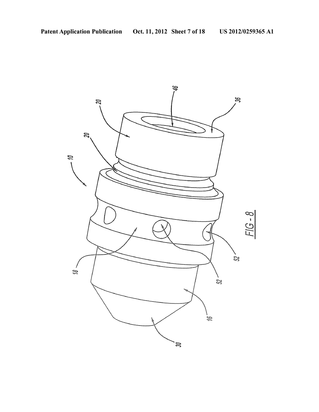 FACET FUSION IMPLANT, INSTRUMENTATION, AND SURGICAL PROCEDURE - diagram, schematic, and image 08