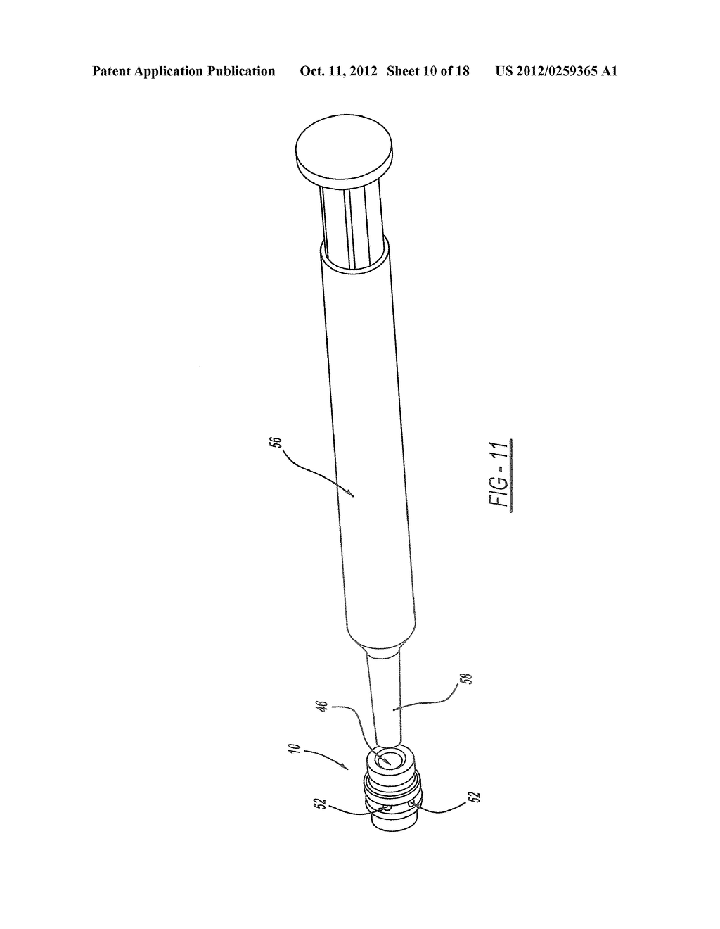 FACET FUSION IMPLANT, INSTRUMENTATION, AND SURGICAL PROCEDURE - diagram, schematic, and image 11