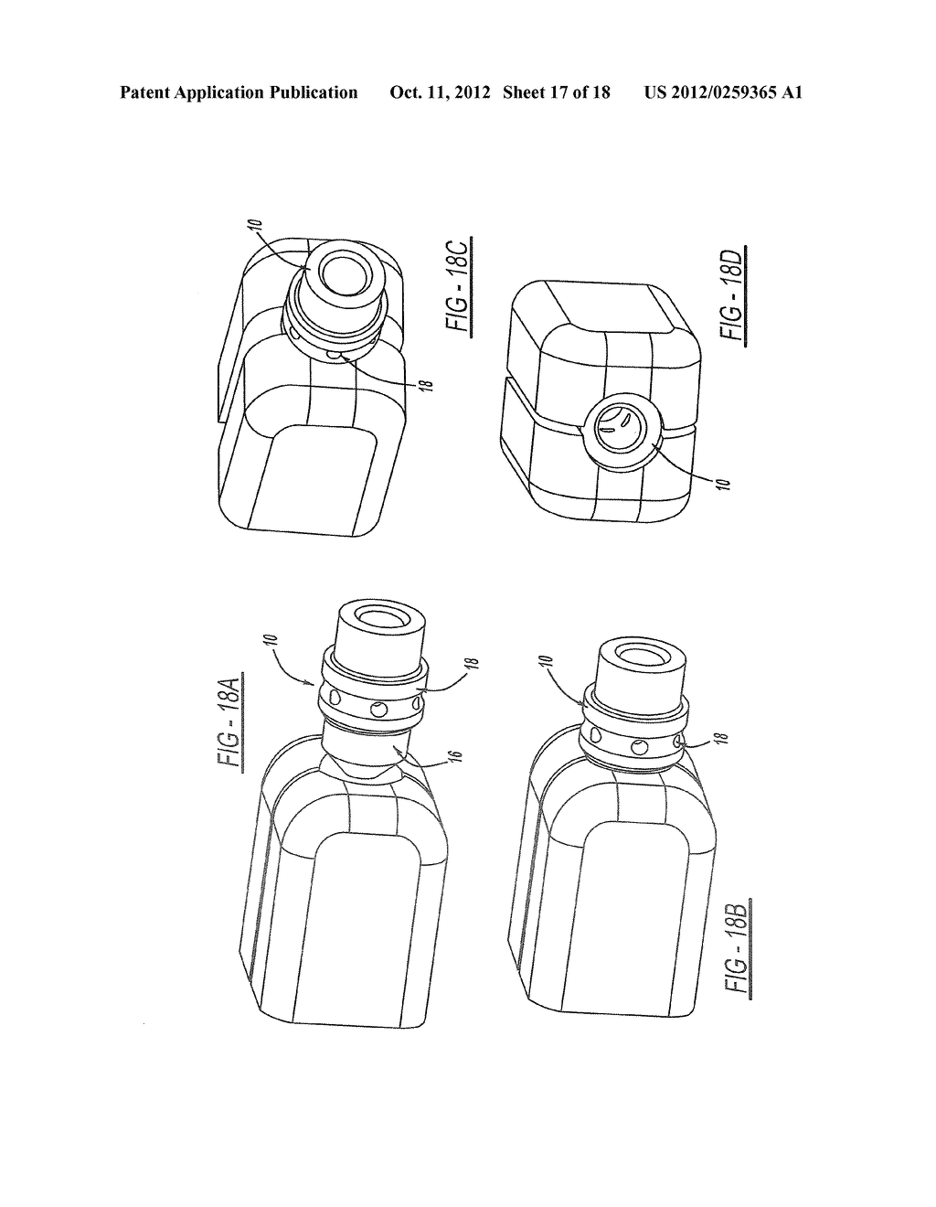 FACET FUSION IMPLANT, INSTRUMENTATION, AND SURGICAL PROCEDURE - diagram, schematic, and image 18