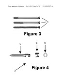 Method for Minimally Invasive Treatment of Unstable Pelvic Ring Injuries diagram and image