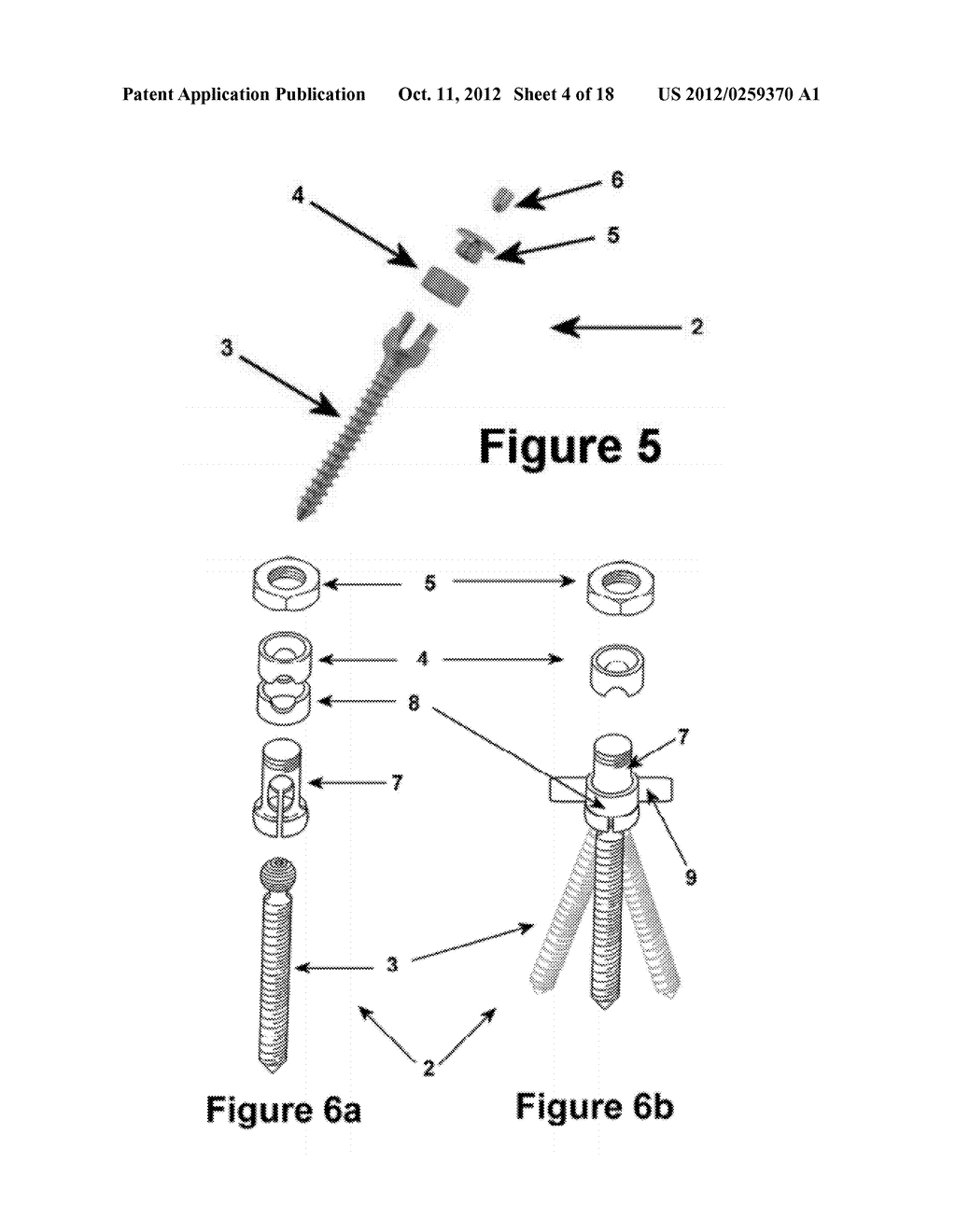 Method for Minimally Invasive Treatment of Unstable Pelvic Ring Injuries - diagram, schematic, and image 05