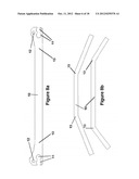 Method for Minimally Invasive Treatment of Unstable Pelvic Ring Injuries diagram and image