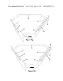 Method for Minimally Invasive Treatment of Unstable Pelvic Ring Injuries diagram and image