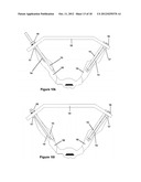 Method for Minimally Invasive Treatment of Unstable Pelvic Ring Injuries diagram and image