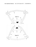 Method for Minimally Invasive Treatment of Unstable Pelvic Ring Injuries diagram and image