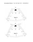 Method for Minimally Invasive Treatment of Unstable Pelvic Ring Injuries diagram and image