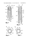 ORTHOPEDIC SCREW INSERT diagram and image