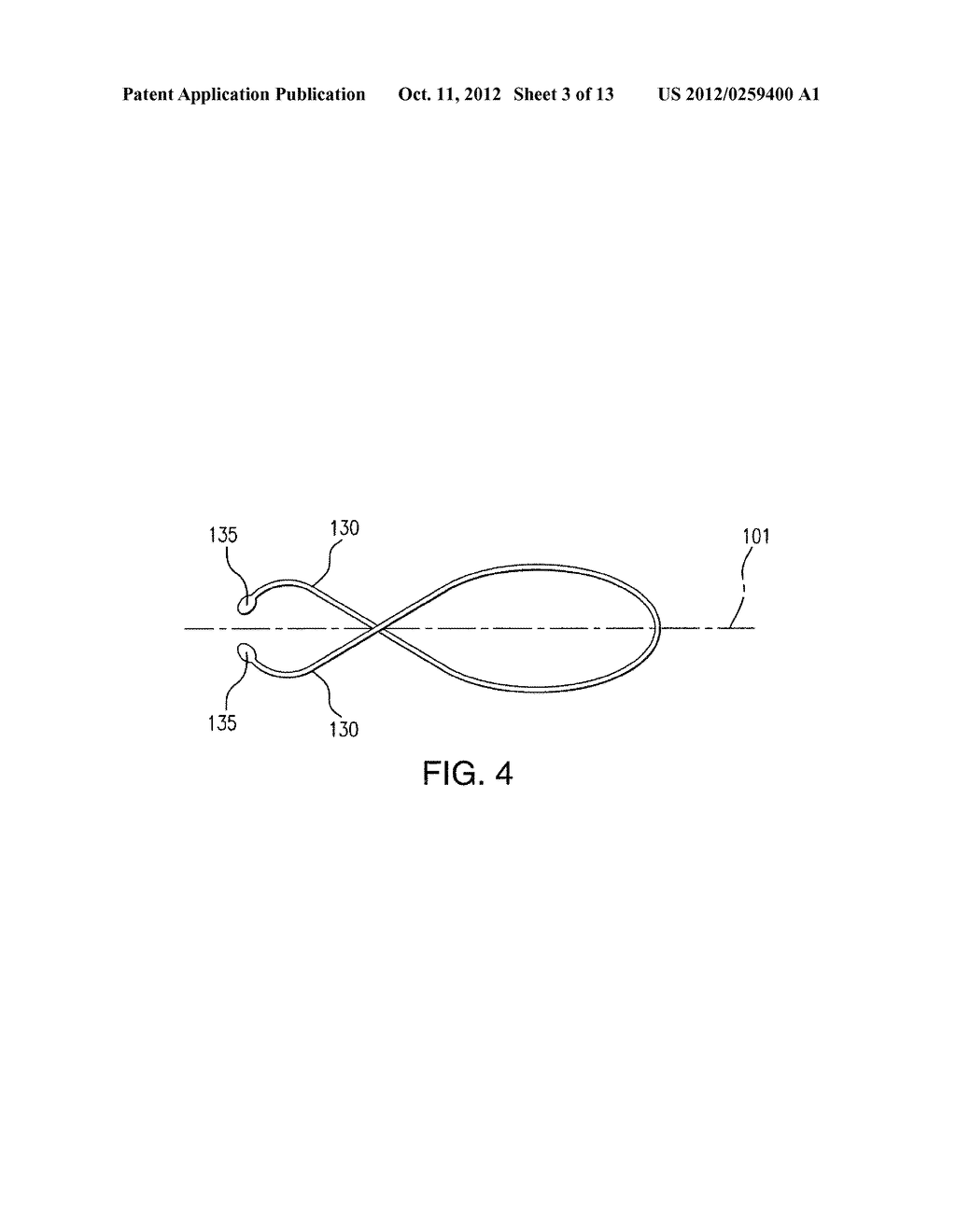 FLEXIBLE INTRALUMINAL SCAFFOLD - diagram, schematic, and image 04