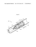 MEDICAL DEVICES FOR MEDICAL DEVICE DELIVERY SYSTEMS diagram and image