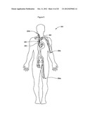 MEDICAL DEVICES FOR MEDICAL DEVICE DELIVERY SYSTEMS diagram and image