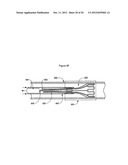 MEDICAL DEVICES FOR MEDICAL DEVICE DELIVERY SYSTEMS diagram and image