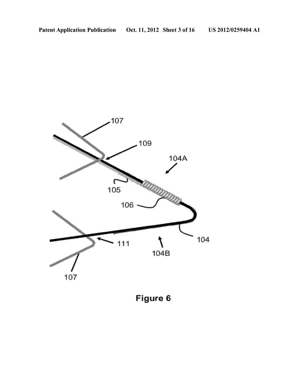 Stent - diagram, schematic, and image 04