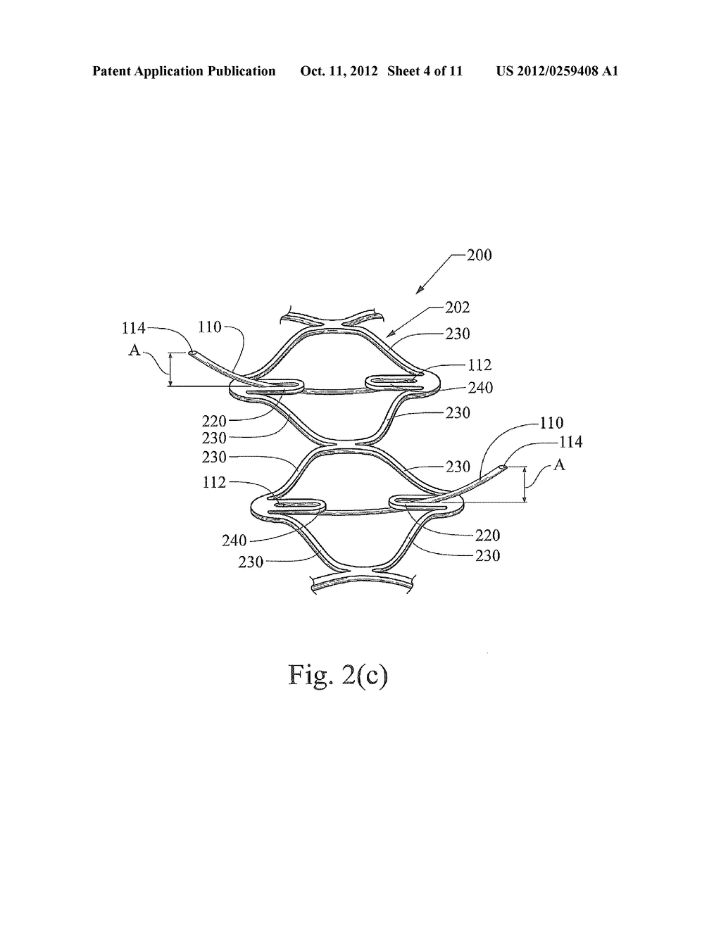 MEDICAL DEVICE WITH ANCHOR MEMBERS - diagram, schematic, and image 05