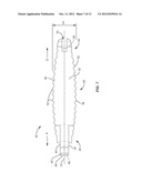 LATERALLY EXPANDABLE INTERBODY SPINAL FUSION IMPLANT diagram and image