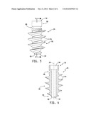 METHOD AND APPARATUS FOR THE TREATMENT OF METATARSOPHALANGEAL JOINT     DEGENERATIVE ARTHRITIS diagram and image