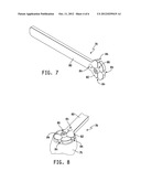 METHOD AND APPARATUS FOR THE TREATMENT OF METATARSOPHALANGEAL JOINT     DEGENERATIVE ARTHRITIS diagram and image