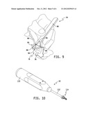 METHOD AND APPARATUS FOR THE TREATMENT OF METATARSOPHALANGEAL JOINT     DEGENERATIVE ARTHRITIS diagram and image