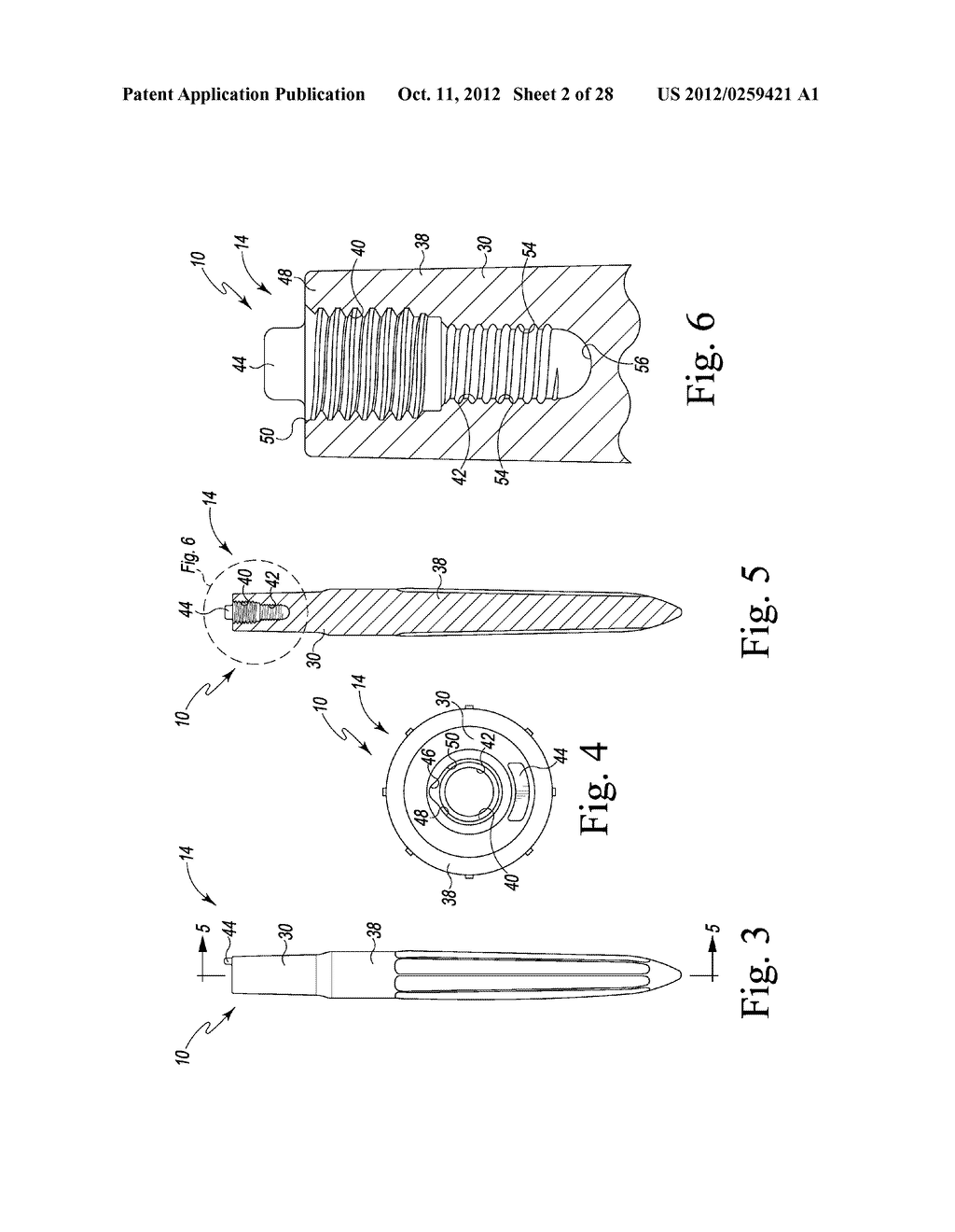 VERSION-REPLICATING INSTRUMENT AND ORTHOPAEDIC SURGICAL PROCEDURE FOR     USING THE SAME TO IMPLANT A REVISION HIP PROSTHESIS - diagram, schematic, and image 03