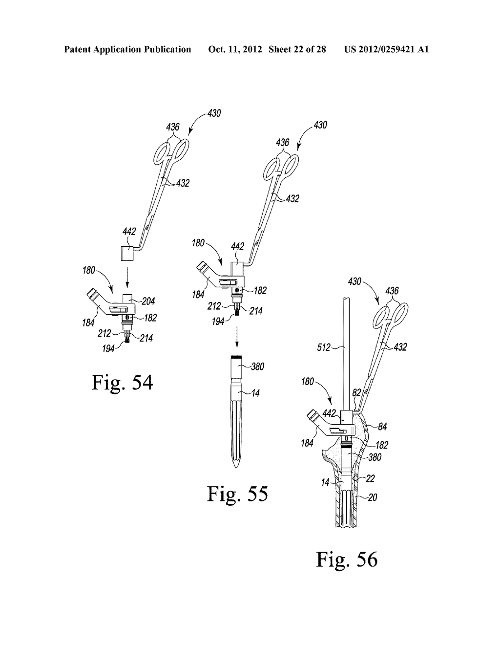 VERSION-REPLICATING INSTRUMENT AND ORTHOPAEDIC SURGICAL PROCEDURE FOR     USING THE SAME TO IMPLANT A REVISION HIP PROSTHESIS - diagram, schematic, and image 23