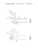 ORTHOPAEDIC SURGICAL PROCEDURE FOR IMPLANTING A REVISION HIP PROSTHESIS diagram and image