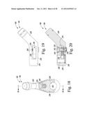 ORTHOPAEDIC SURGICAL PROCEDURE FOR IMPLANTING A REVISION HIP PROSTHESIS diagram and image