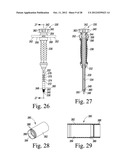 ORTHOPAEDIC SURGICAL PROCEDURE FOR IMPLANTING A REVISION HIP PROSTHESIS diagram and image