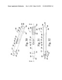 ORTHOPAEDIC SURGICAL PROCEDURE FOR IMPLANTING A REVISION HIP PROSTHESIS diagram and image