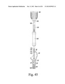 ORTHOPAEDIC SURGICAL PROCEDURE FOR IMPLANTING A REVISION HIP PROSTHESIS diagram and image