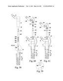 ORTHOPAEDIC SURGICAL PROCEDURE FOR IMPLANTING A REVISION HIP PROSTHESIS diagram and image