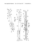 REVISION HIP PROSTHESIS HAVING AN IMPLANTABLE DISTAL STEM COMPONENT diagram and image