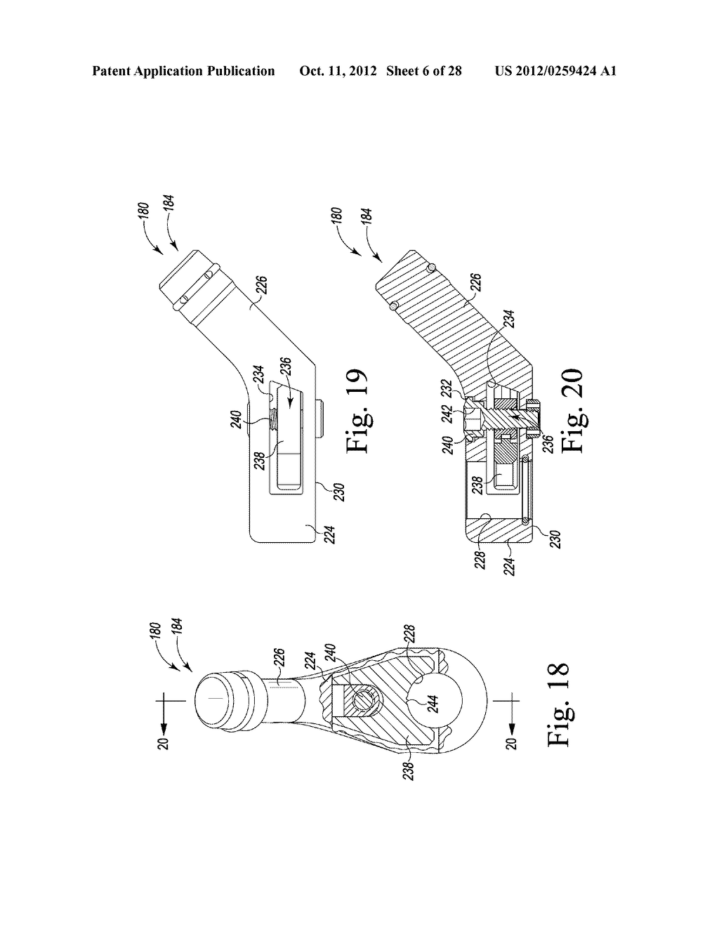 REVISION HIP PROSTHESIS HAVING AN IMPLANTABLE DISTAL STEM COMPONENT - diagram, schematic, and image 07