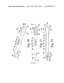 REVISION HIP PROSTHESIS HAVING AN IMPLANTABLE DISTAL STEM COMPONENT diagram and image