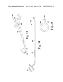 REVISION HIP PROSTHESIS HAVING AN IMPLANTABLE DISTAL STEM COMPONENT diagram and image