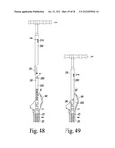 REVISION HIP PROSTHESIS HAVING AN IMPLANTABLE DISTAL STEM COMPONENT diagram and image