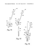 REVISION HIP PROSTHESIS HAVING AN IMPLANTABLE DISTAL STEM COMPONENT diagram and image