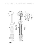 REVISION HIP PROSTHESIS HAVING AN IMPLANTABLE DISTAL STEM COMPONENT diagram and image