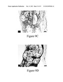 PLGA/HYDROXYAPATITE COMPOSITE BIOMATERIAL AND METHOD OF MAKING THE SAME diagram and image