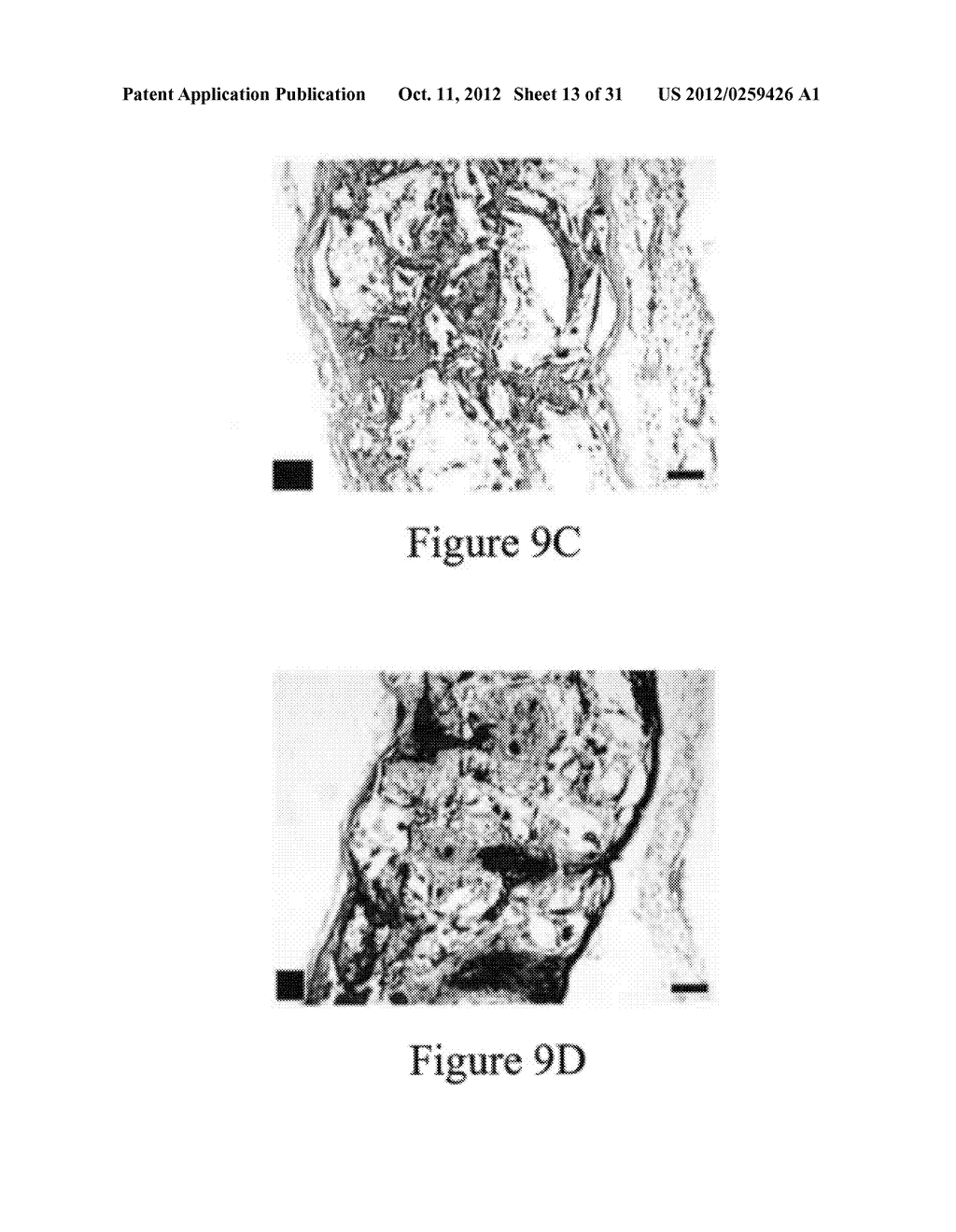PLGA/HYDROXYAPATITE COMPOSITE BIOMATERIAL AND METHOD OF MAKING THE SAME - diagram, schematic, and image 14