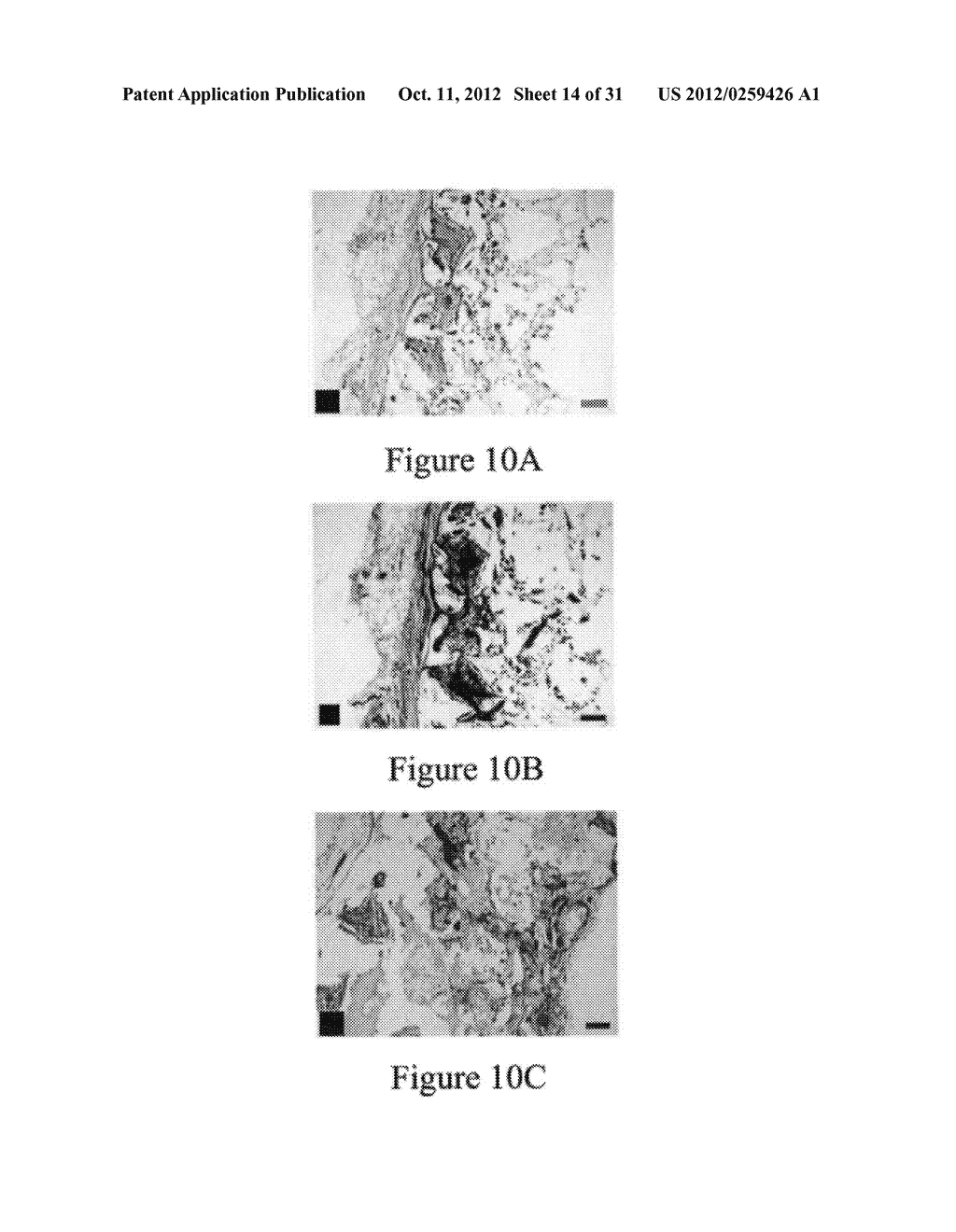 PLGA/HYDROXYAPATITE COMPOSITE BIOMATERIAL AND METHOD OF MAKING THE SAME - diagram, schematic, and image 15