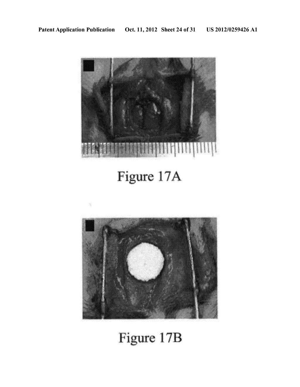 PLGA/HYDROXYAPATITE COMPOSITE BIOMATERIAL AND METHOD OF MAKING THE SAME - diagram, schematic, and image 25