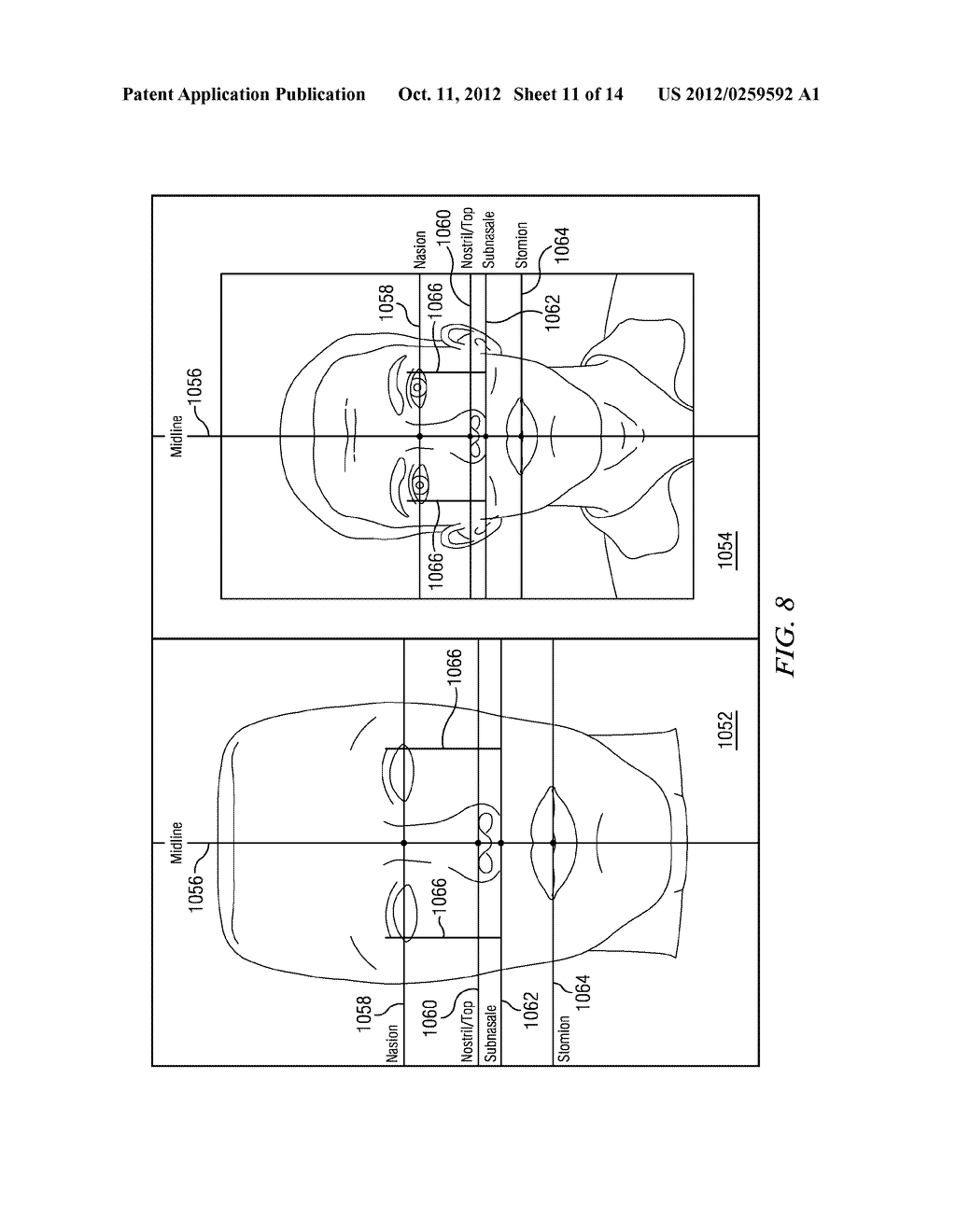 System and Method for Three-Dimensional Maxillofacial Surgical Simulation     and Planning - diagram, schematic, and image 12