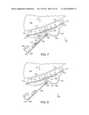 Systems and Methods for Cleaning and Conditioning a Moving Surface Using     Cleaning Apparatus with Plate Elements for Mounting to Doctor Blade     Holders diagram and image