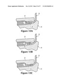 Method Of Lasting An Article Of Footwear With A Fluid-Filled Chamber diagram and image