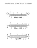 Method Of Lasting An Article Of Footwear With A Fluid-Filled Chamber diagram and image