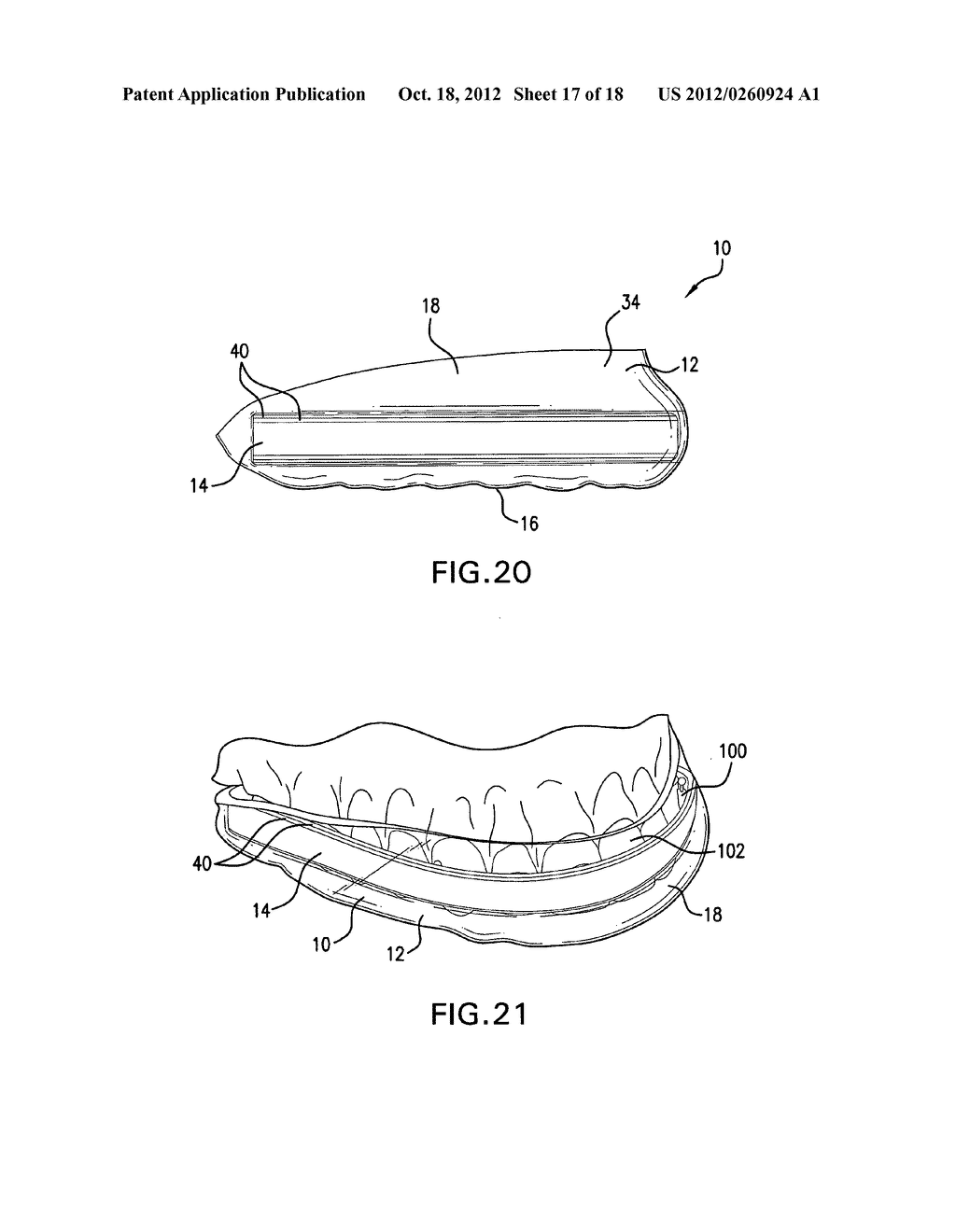 Mouthguard - diagram, schematic, and image 18