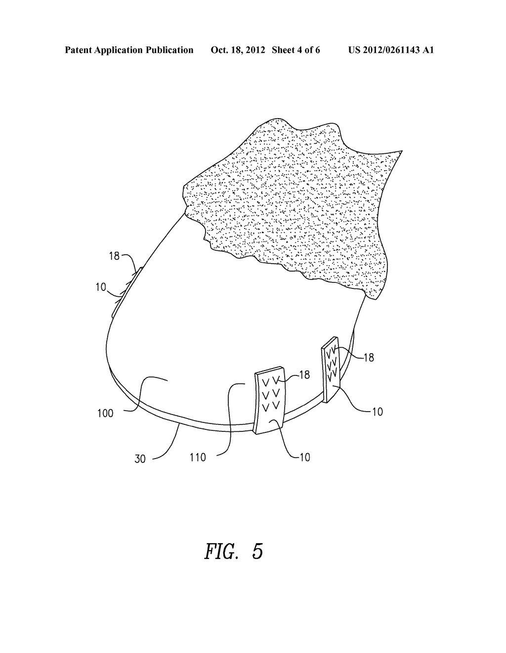 DEVICES AND METHODS FOR ATTACHING A HORSESHOE TO A HOOF - diagram, schematic, and image 05