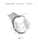 DEVICES AND METHODS FOR ATTACHING A HORSESHOE TO A HOOF diagram and image