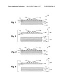 Prosthetic Appliance Transfer Kit and Method diagram and image