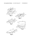 Prosthetic Appliance Transfer Kit and Method diagram and image