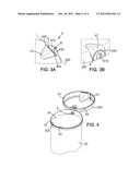 FOOD PACKAGING WITH A LID AND CLOSURE SYSTEM FOR PACKAGING diagram and image